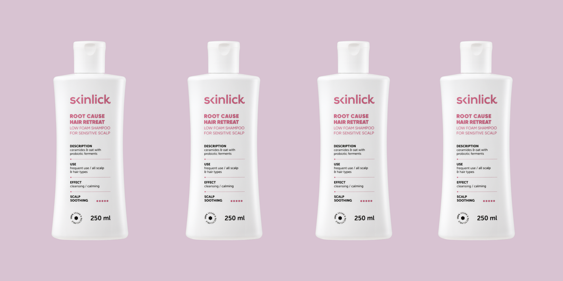 Kako se brinuti za osetljivo vlasište?